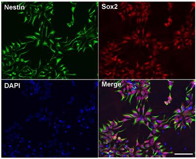 The Effect of IDO on Neural Progenitor Cell Survival Under Oxygen Glucose Deprivation